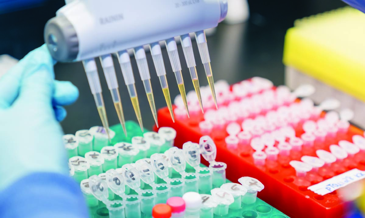 Specimens are being pipetted in ARUP’s Electrophoresis and Manual Endocrinology Laboratory.
